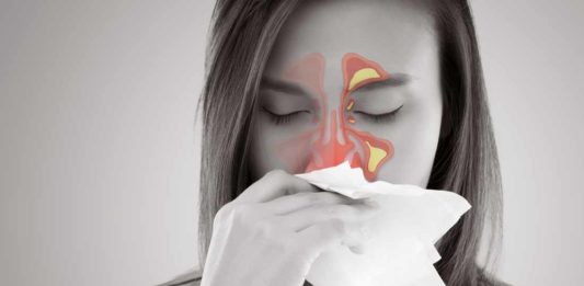 curar sinusitis - Noticias Ahora