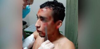 venezolano atacado en peru