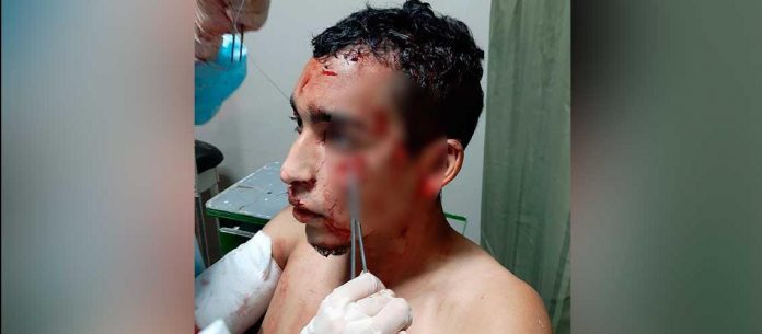 venezolano atacado en peru