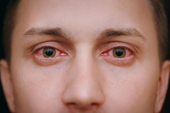 Problemas en los ojos por el Coronavirus