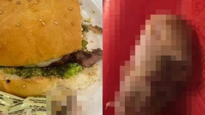 Mujer encuentra dedo humano dentro de una hamburguesa