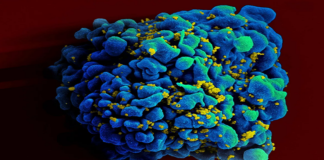 proteína que bloquea la multiplicación del VIH