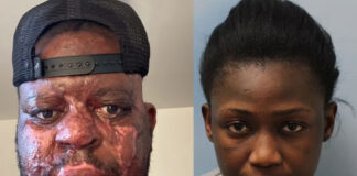 Mujer arroja acido sobre su esposo dormido - Noticias Ahora