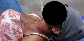 Mujer recibió brutal golpiza de su novio - NA