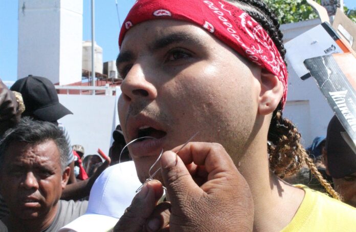 venezolanos se cosen la boca