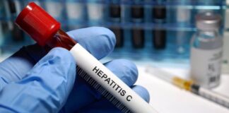 hepatitis aguda infantil