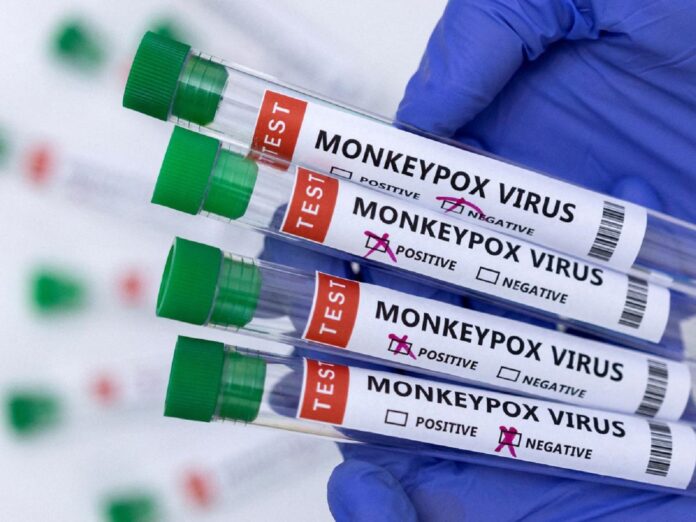 primer caso de viruela del mono en Venezuela