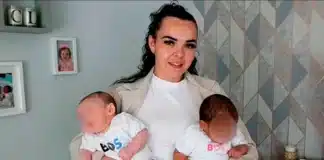Mellizos con tono de piel diferente
