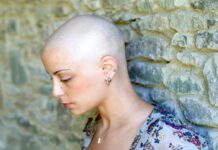 Por qué se cae cabello quimioterapia