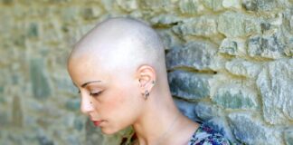 Por qué se cae cabello quimioterapia