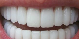 Remedios naturales sensibilidad dental