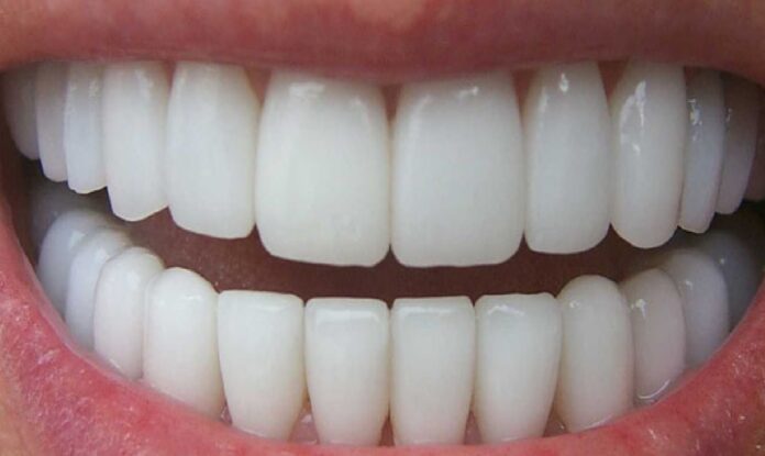 Remedios naturales sensibilidad dental