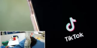 Colombia: Niño terminó gravemente quemado por hacer reto viral de TikTok