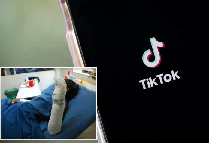 Colombia: Niño terminó gravemente quemado por hacer reto viral de TikTok