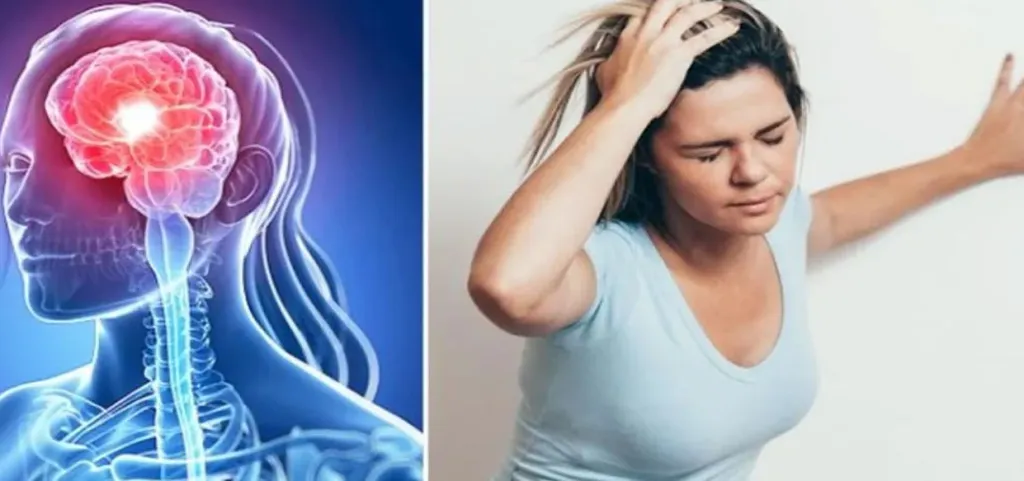 Señales advierten derrame Cerebral