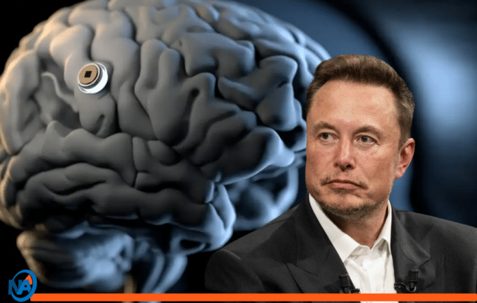 Elon Musk Neuralink chip cerebral inalámbrico