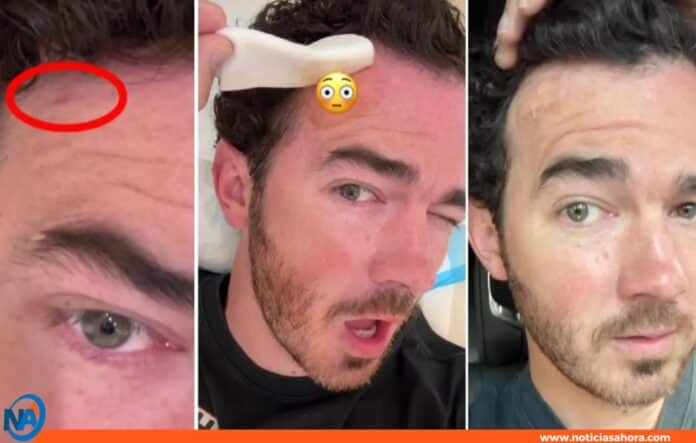kevin jonas cáncer de piel
