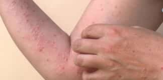 Alerta sanitaria en Tailandia
