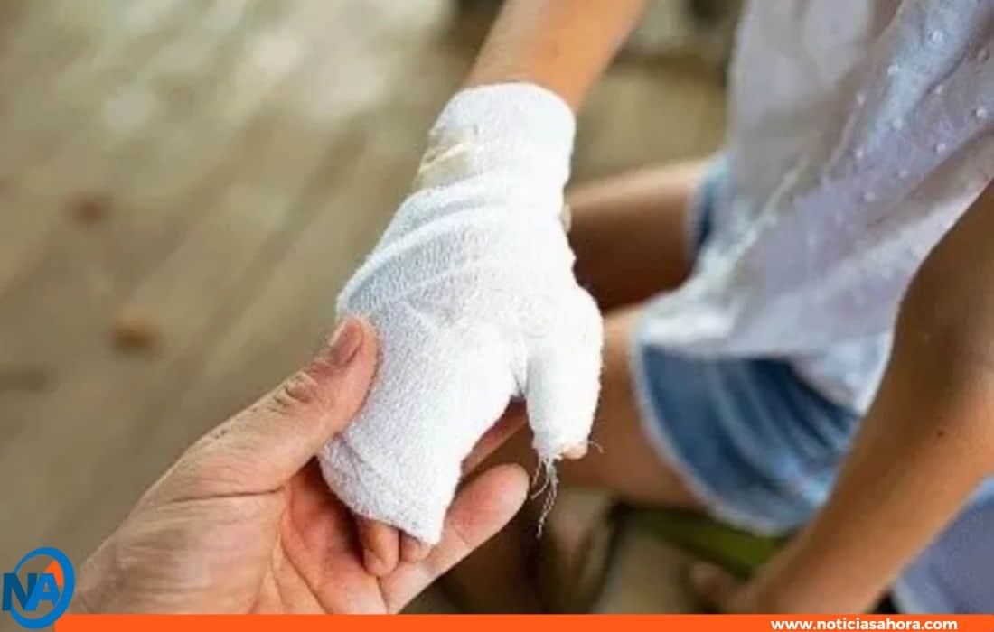  Madre le quemo la mano a su hija