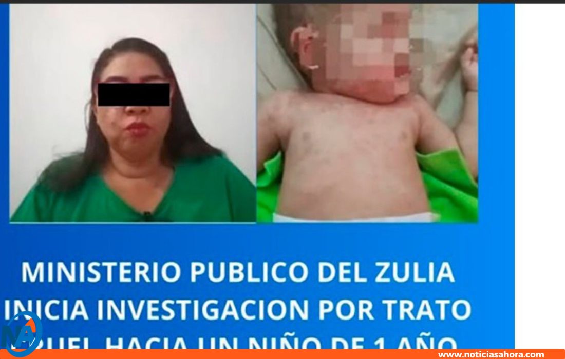 MP abre investigación en el Zulia.0