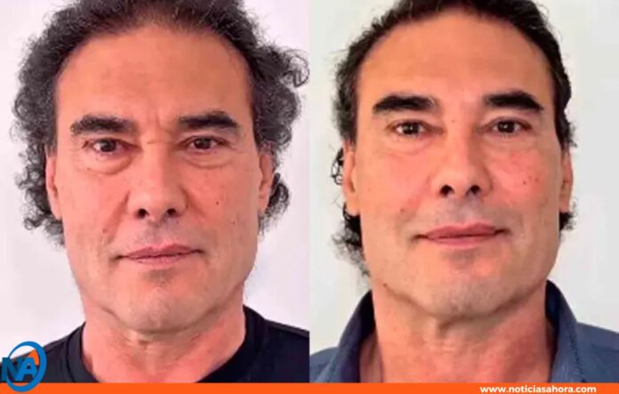 tratamiento estético Eduardo Yáñez tratamiento estético Eduardo Yáñez