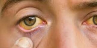 amarillo los ojos