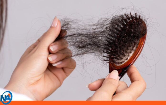 caída del cabello caída del cabello