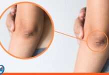 ¿Piel seca en las articulaciones? Guía definitiva para hidratar codos y rodillas codos rodillas