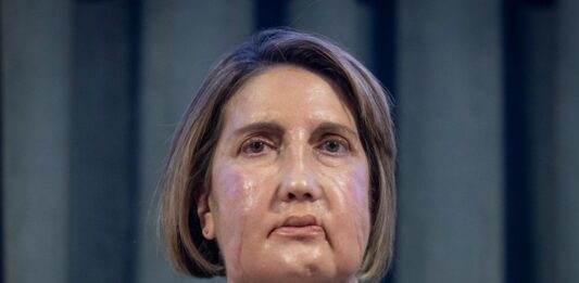 trasplante cara España