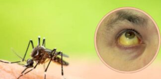 fiebre amarilla síntomas