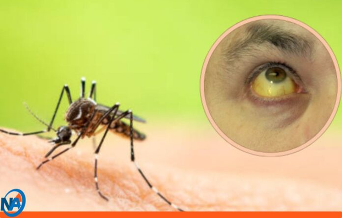 fiebre amarilla síntomas fiebre amarilla síntomas