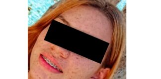Joven de 19 años murió arrollada en Morón-Coro de Tucacas