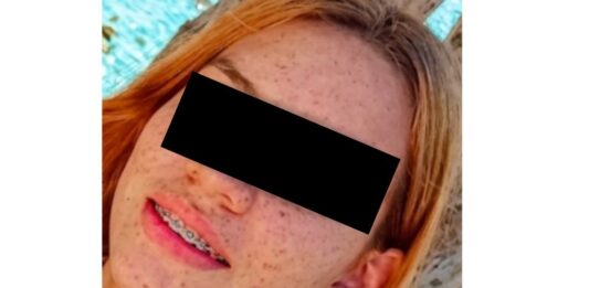 Joven de 19 años murió arrollada en Morón-Coro de Tucacas