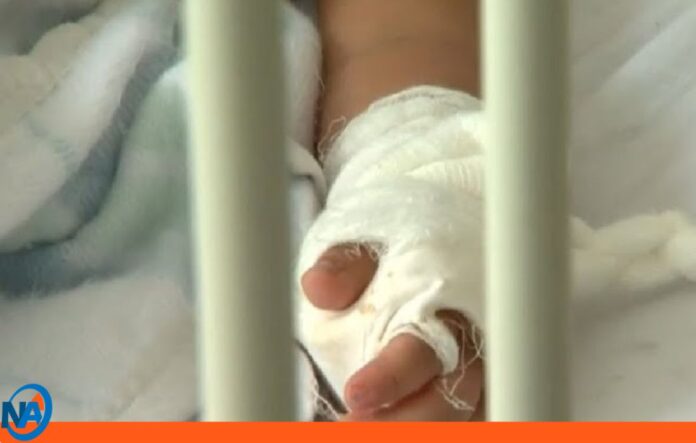 Bebe quemado olla hirviendo en Lara Bebe quemado olla hirviendo en Lara