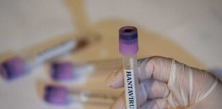 Brasil hombre fallece por hantavirus