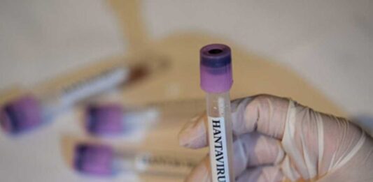 Brasil hombre fallece por hantavirus