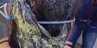 Hombre atacó pareja pegamento cabello