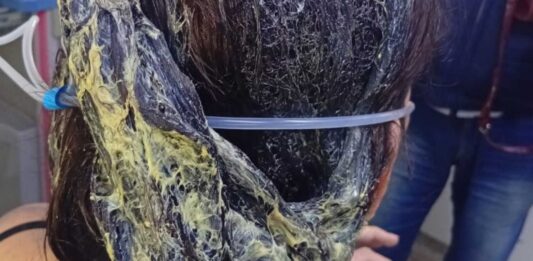 Hombre atacó pareja pegamento cabello