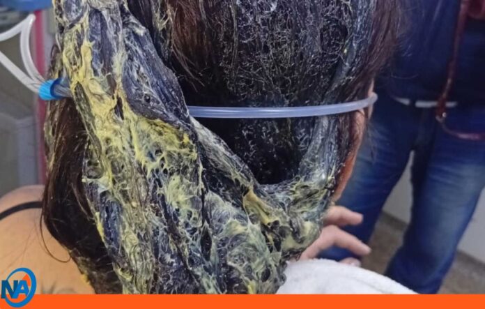 Hombre atacó pareja pegamento cabello