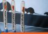 Ministerio de Salud confirma tres fallecidos por hantavirus en Anzoátegui hantavirus Anzoátegui