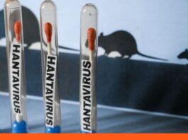 hantavirus Anzoátegui