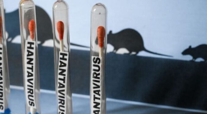 Ministerio de Salud confirma tres fallecidos por hantavirus en Anzoátegui hantavirus Anzoátegui